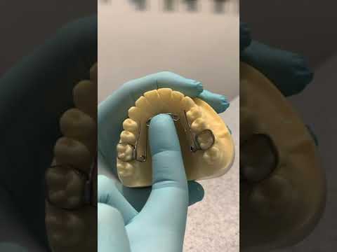 How To Bounce Your Quad-Helix Expander