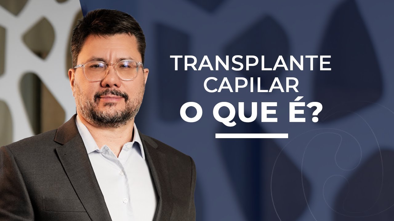 Transplante Capilar em SP