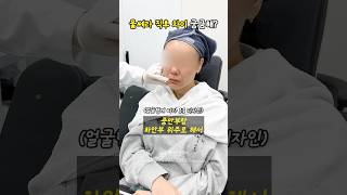 착붙 V라인 울쎄라 후기 🫶