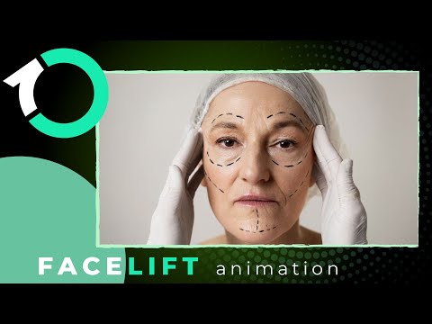 Deep Plane Facelift & Neck Rejuvenation - Surgical Procedure - One Clinic Patient Review Video