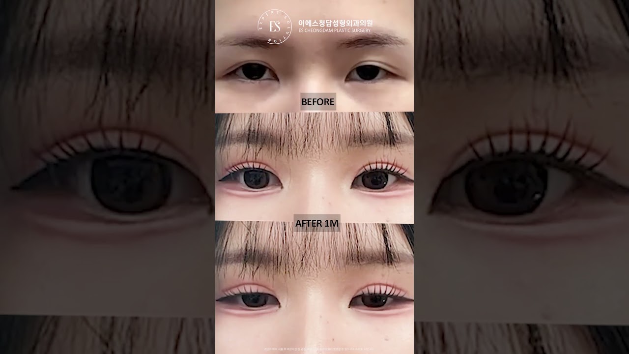 이에스 유튜브