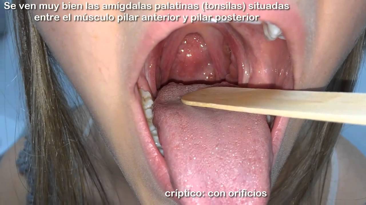 Examen físico - Boca y orofaringe