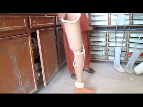 Artificial limbs