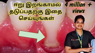 ஈறு இறங்காமல் தடுப்பதற்கு என்ன செய்ய வேண்டும்? How to stop gum recession at home (in Tamil)?