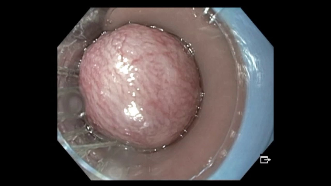 Adriana Fabiola Romano Munive-20