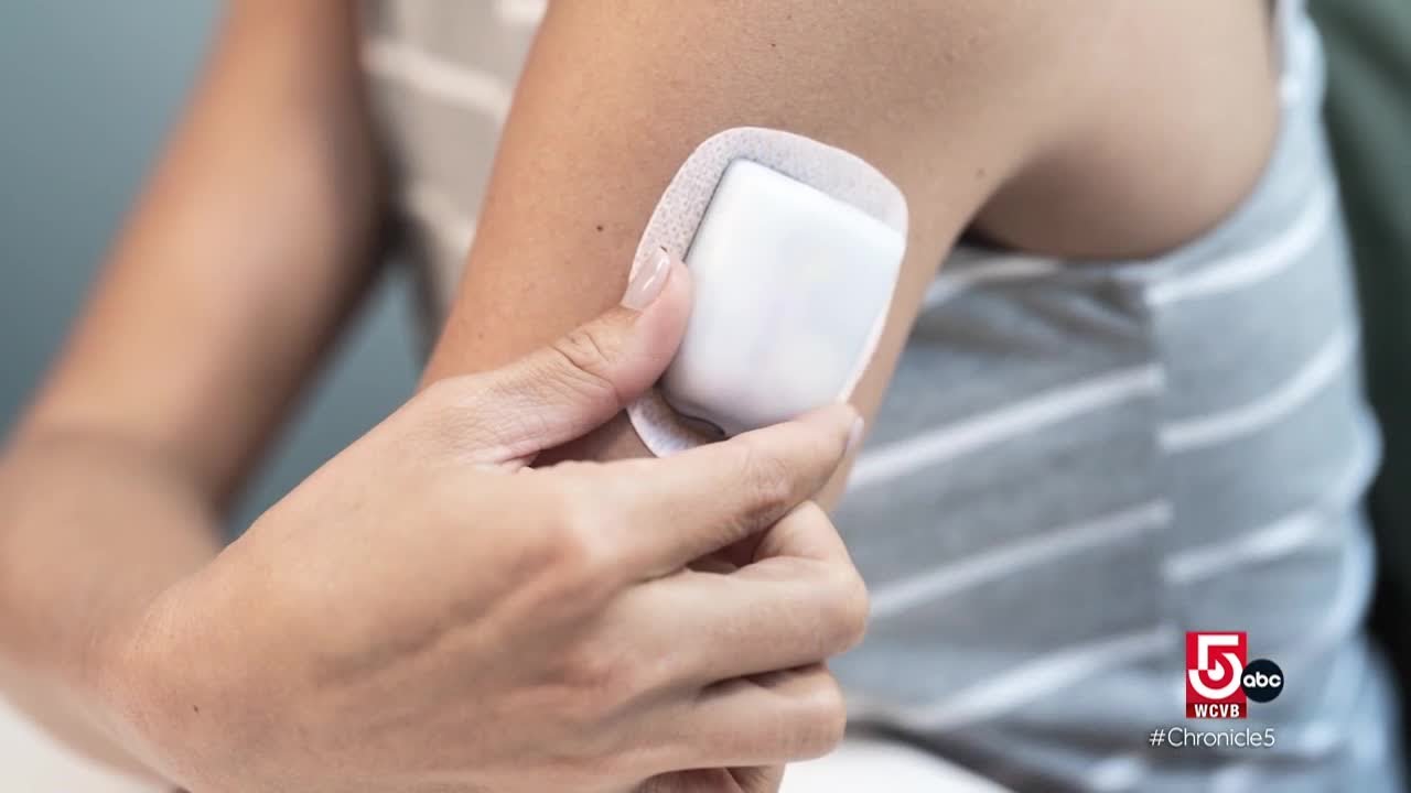 Continuous glucose monitors make waves in diabetes technology, and on TikTok