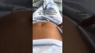 Baby girl is finally kicking from the outside at 22 weeks with an anterior placenta #twinpregnancy