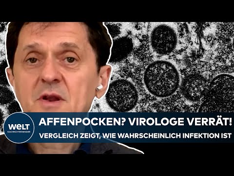 AFFENPOCKEN: Virologe verrät! Dieser Vergleich zeigt, wie wahrscheinlich eine Infektion wirklich ist