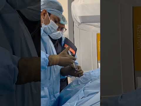 Femoral Endarterectomy Surgery- 2 : Treatment for Blocked Leg Arteries | Dr. Abhilash V