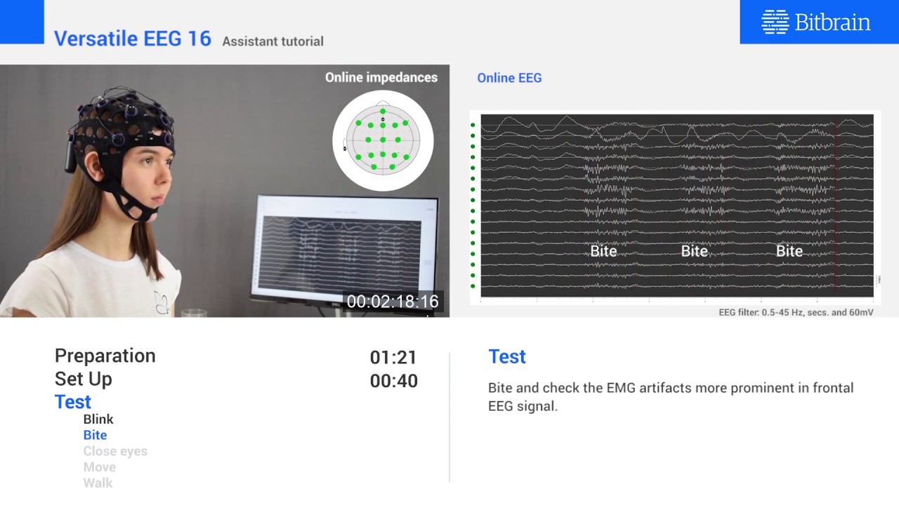 Versatile EEG 16 - Mobile and wireless semi-dry EEG with 16 channels
