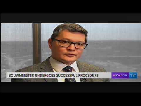 Michael Lim explains ICDs