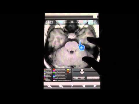 Brain MRI Sectional Wlker Video