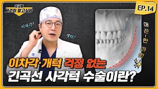 [얼굴뼈 그알] 긴곡선 사각턱 수술이란?｜1%성형외과  #임종우 #윤곽수술 #일퍼센트성형외과