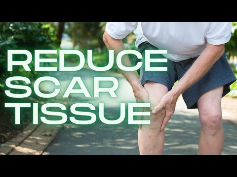 How to Get Rid of Knee Scar Tissue NOW (& Naturally)