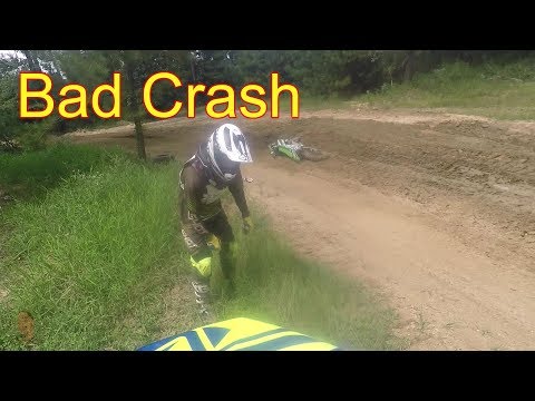 He Crashed Hard | Full Throttle MX | Broken Bones