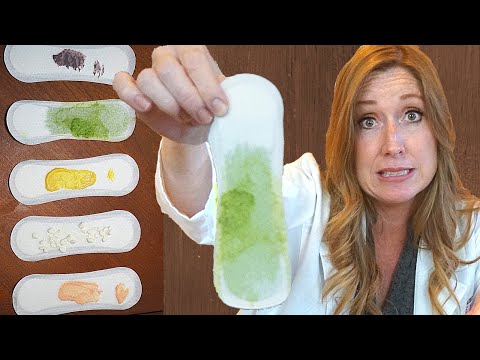 Vaginal Discharge Colors | Bacterial Vaginosis, Yeast Infections, Thrush, STI | Is Discharge Normal