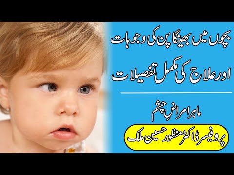 Squint (Bhengapan) treatment without surgery | Lazy eye exercise | Urdu/Hindi