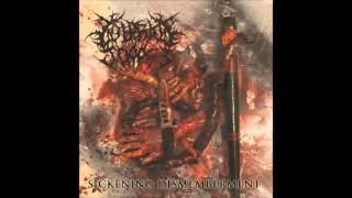 Putrid Corpse - Sickening Dismemberment 2015 EP