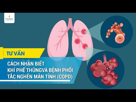 , title : 'Cách nhận biết khí phế thũng và bệnh phổi tắc nghẽn mạn tính (COPD)'