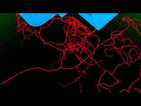 Liquid versus Bait Termite Treatment Systems