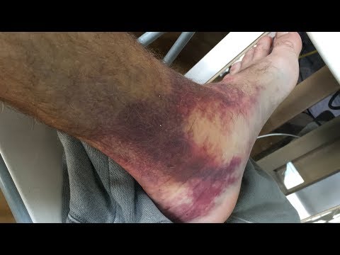 Parkour Fails Are Always A Fun, Painful Watch