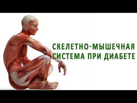 Ортопедия при остеохондрозе шейного отдела Посттравматический артроз плечевого сустава