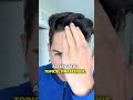Combined Topical Finasteride And Minoxidil Is The Finasteride Hairlosstreatment Hairloss