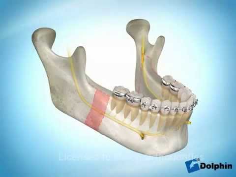 Pianificare unosteocondrosi massaggio integrata Dolore al collo dietro il lato sinistro