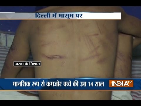 Neighbours Torture Mentally Challenged Boy in Delhi