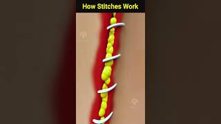 How wound stitches really work  #shorts #facts - Creativelearning3d