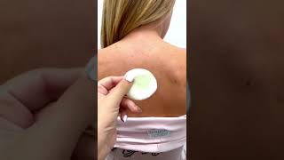 HOW I CLEARED MY BACK ACNE | SMOOTH SKIN ROUTINE #shorts