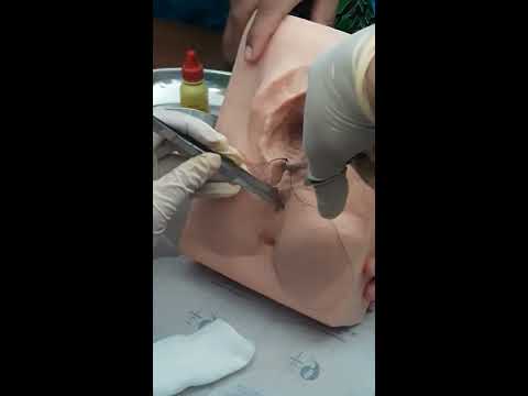 download lagu mp3 mp4 Cara Agar Luka Jahitan Melahirkan Normal Cepat Kering, download lagu Cara Agar Luka Jahitan Melahirkan Normal Cepat Kering gratis, unduh video klip Cara Agar Luka Jahitan Melahirkan Normal Cepat Kering