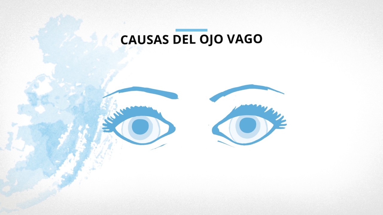 Watch Ojo vago: síntomas, causas y solución | Clínica Baviera Now Ojo vago: síntomas, causas y solución | Clínica Baviera