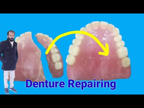 How to Repair a broken denture || Dentur Repairing by Haider.........