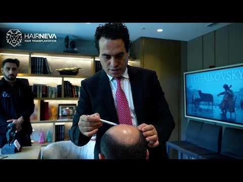 Two Patients, Two Unique Hair Transplant Journeys in Istanbul, Turkey: Different Experiences at HairNeva