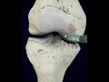 The Best Treatment For Knee Arthritis