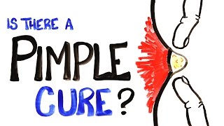 Is There A Pimple Cure?