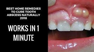 how to drain a tooth abscess at home| home remedies for tooth abscess|tooth abscess pain relief fast