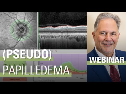 Differentiating Papilledema from Pseudopapilledema with OCT  | SPECTRALIS