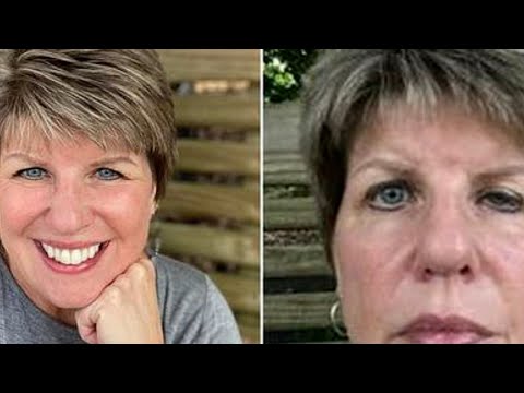 55 vjecarja beri botox por shikoni cfare i ndodh me pas