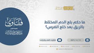 صورة ما حكم بلع الدم المختلط بالريق بعد خلع الضرس؟  - الشيخ عبدالرحمن البراك (12731)