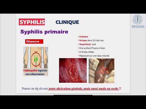 Extrait objectif 44 – IST