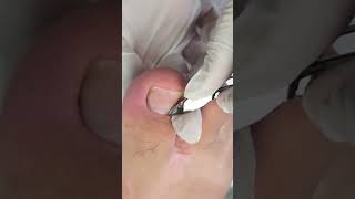 Cutilagem e Decoração , Pedicure Perfeita Sem Manchas