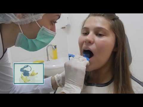 Técnicas radiográficas: Periapical com uso do posicionador e Interproximal