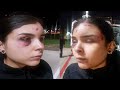 Woman Beaten By Group Of Men After Hitting Girl With Vehicle