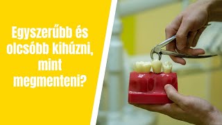 Egyszerűbb és olcsóbb kihúzni a fogat, mint megmenteni?