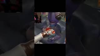 What happens when you Stabe Gene(High on Life)