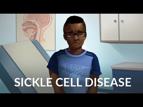 Sickle Cell Disease by V. Tran, N. Archer | OPENPediatrics