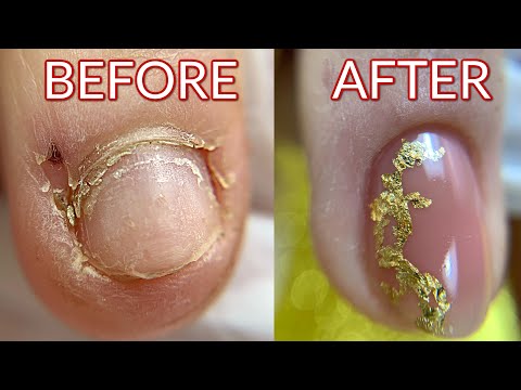 How to Take Care Of Your Nails While Having Extensions | Modelones Cuticle Oil Set