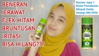 Download lagu Review Jujur 1 Bulan Pemakaian Minyak Herba Sinerg... mp3